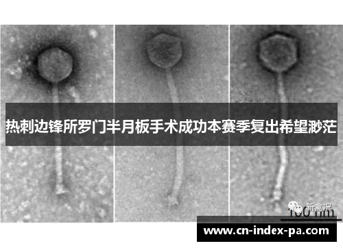 热刺边锋所罗门半月板手术成功本赛季复出希望渺茫